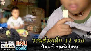 วอนช่วยเด็ก11ขวบป่วยครัวซองซินโดรม | แคนช่วยได้ | ข่าวช่องวัน | one31