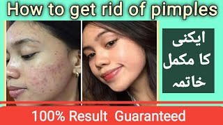How To Remove Pimples Overnight | Acne Treatment | Cee Beauty
