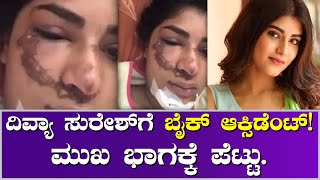 Divya Suresh | ದಿವ್ಯಾ ಸುರೇಶ್‌ಗೆ ಆಕ್ಸಿಡೆಂಟ್ ಆಗಿದ್ದು ಎಲ್ಲಿ?ಹೇಗೆ?