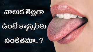 అలర్ట్  నాలుక తెల్లగా ఉంటే క్యాన్సర్ కు సంకేతమా | alert nalika thalaga unte cancer ku sankatham?