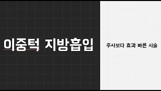 이중턱 지방흡입 (울트라 Z 사용 !! 매끈하고 탄탄한 턱라인 !!)