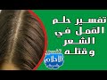 Interpretation of a dream about lice in the hair and killing them | Ibn Sirin