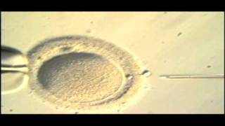 Intracytoplasmic Sperm Injection (ICSI) | Nashville Fertility Center