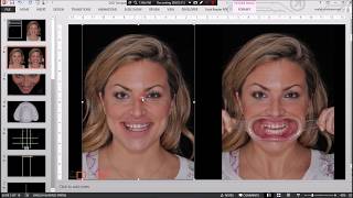 Digital Smile Design DSD using Microsoft PowerPoint - Full protocol