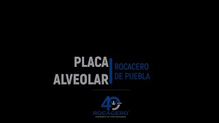 Colocación Placa Alveolar