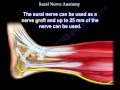 Sural Nerve Anatomy - Everything You Need To Know - Dr. Nabil Ebraheim