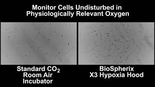 The Xvivo System® Keeps Cells Happy! Xvivo X3 vs. Standard Room Air