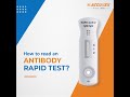 How to read an Antibody COVID19 test? | Accurex Biomedical