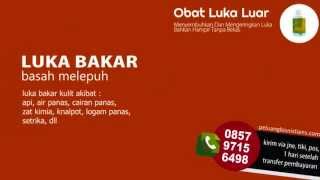 0857 9715 6498 (M3), Obat Luka Bakar, Obat Luka Bakar Alami Agar Cepat Kering