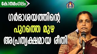 ഗർഭാശയത്തിൻ്റെ പുറത്തെ മുഴ അപ്രത്യക്ഷമായ രീതി