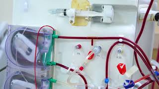 BBRAUN Dialysis Machine