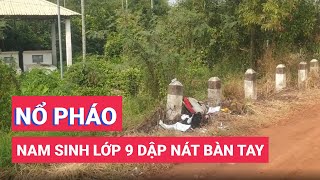 Chơi pháo bị phát nổ, nam sinh lớp 9 dập nát bàn tay