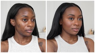 My NO FOUNDATION Summer Makeup Routine | Cover Acne Scars & Hyperpigmentation Without Foundation