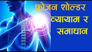 फ्रोजन शोल्डर- व्यायाम र समाधान, Frozen Shoulder; Dr Chetana; Dr. Sunil Paudel; बिना अप्रेसन