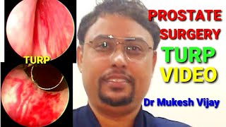 Transurethral resection of ProstateTURP\Prostate operation \turp operation\ turp surgery\bph surgery