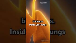 Bronchoscopy inside your lungs (3D Animation)