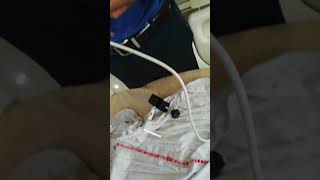 Aerogen Pro nebulizer in icu