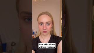 #acne #acneskincare real skin with and without makeup #realskin #texture