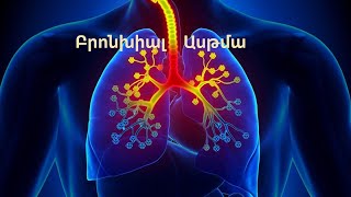 ԲՐՈՆԽԻԱԼ ԱՍԹՄԱ /Asthma/2021 #medicine #youtube #best #viral