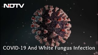 COVID-19 Fallout: What Is White Fungus Infection?