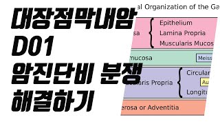 대장점막내암 D01 암진단비 분쟁 해결하기