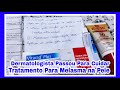 DERMATOLOGISTA PASSOU TRATAMENTO PARA MELASMA