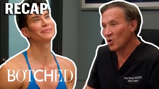 Human Ken Doll & Sagging Triple T's: "Botched" RECAP (S7, E15) | Botched | E