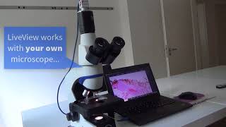 PathoZoom LiveView