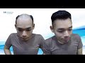 Hair system Hairsetup- Shower -Swim –Exercise-