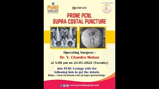 Prone PCNL - Supra Costal Puncture