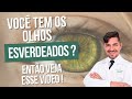 Das 3 cores principais dos olhos, o que o esverdeado pode nos indicar?