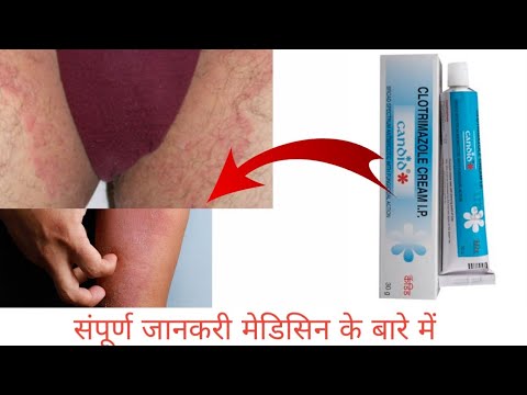 Clotrimazole Cream Ip Uses | Fungal Infection Clotrimazole Cream Uses ...