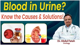 What is the main cause of blood in urine || How to reduce blood in urine || signs of Hematuria