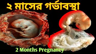 ২ মাসের গর্ভবতী। 2 Months of Pregnancy .