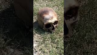 WALTER FOUND A HUMAN SKULL