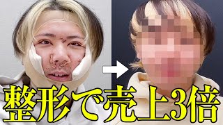 【顔面フル整形ホスト】3ヶ月完全密着｜まさかの涙…【ビフォーアフター】