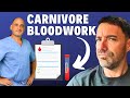 Carnivore Bloodwork after 1 Year! Cholesterol? Top Heart Surgeon Reviews My Results