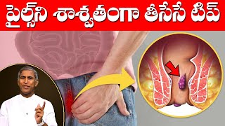 Piles Control Tips In Telugu | పైల్స్ ని శాశ్వతంగా తీసేసే టిప్ | Dr Manthena Satyanarayana Raju