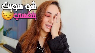 بسبب غلطة صغيرة خربت وجهي🥲 أسوء شي صار معي