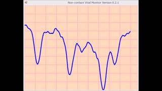 赤外線非接触バイタルセンサの測定波形