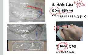 마취과간호사 - E tube종류(Silastic, A node, RAE tube)