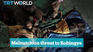 Rohingya refugee children under threat from malnutrition