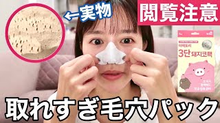 角栓 オロナイン毛穴パックはやっぱすげぇ Pore Pack Close Up 角栓 オロナイン毛穴パックはやっぱすげぇ Pore Pack Close Up