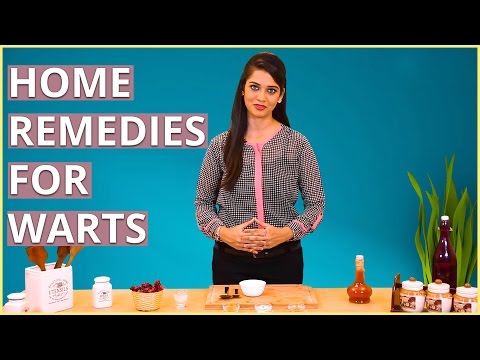 3 Best Home Remedies TO GET RID OF WARTS On Face & Neck 3 Best Home Remedies TO GET RID OF WARTS On Face & Neck