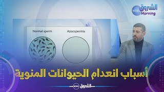 انعدام الحيوانات المنوية.. الأسباب الصحية و أحدث تقنيات العلاج