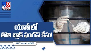 Black Fungus : యూపీలో తొలి బ్లాక్‌ ఫంగస్‌ కేసు!  - TV9