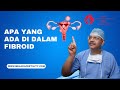 Apa yang Ada di Dalam Fibroid?