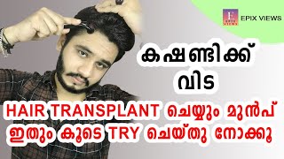 Hair Loss Reasons And Treatment Malayalam | ഹെയർ ട്രാൻസ്‌പ്ലാന്റ് ചെയ്യും മുൻപ് ഇത് ട്രൈ ചെയ്യൂ