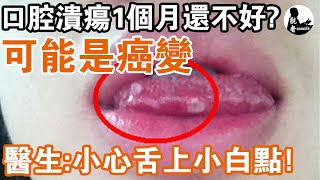 Beware of oral ulcers for 1 month! Could it be cancerous? Doctor: Don't ignore this white spot