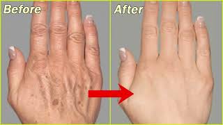 How to Make Your Hands Look 5 Years Younger Overnight! Wrinkle-free smooth fair hands#beauty